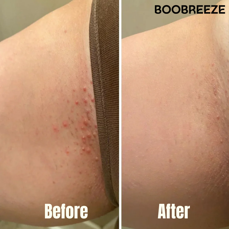 Boobreeze™ Glide Smooth Razor Shaver