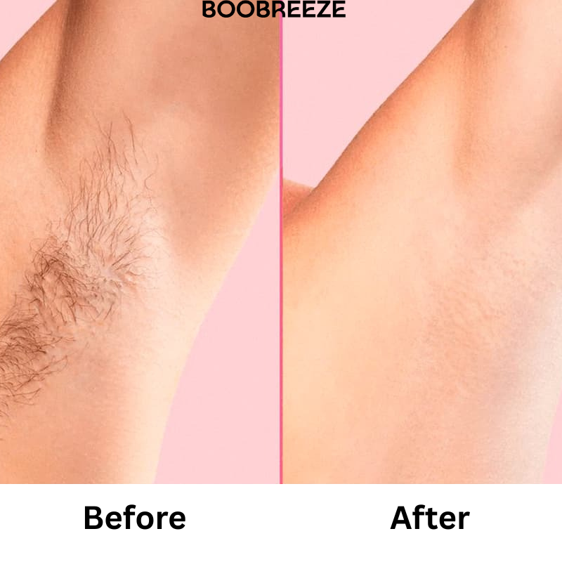 Boobreeze™ Pain Free Permanent Hair Removal