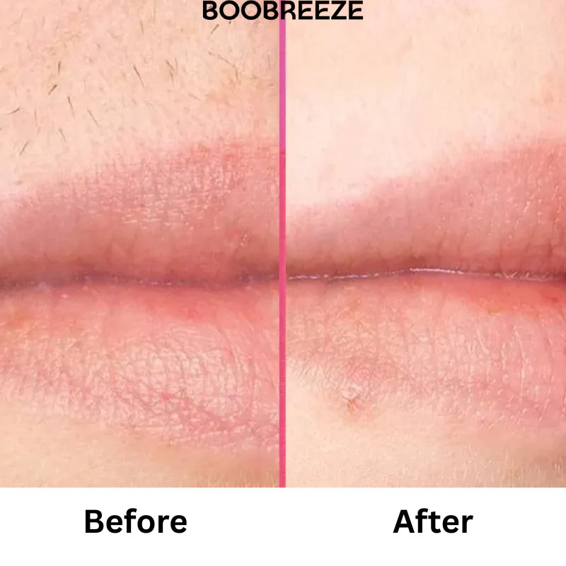 Boobreeze™ Pain Free Permanent Hair Removal