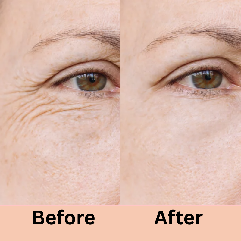 Boobreeze™ LED Face Lifter – 7-in-1 Skincare Solution