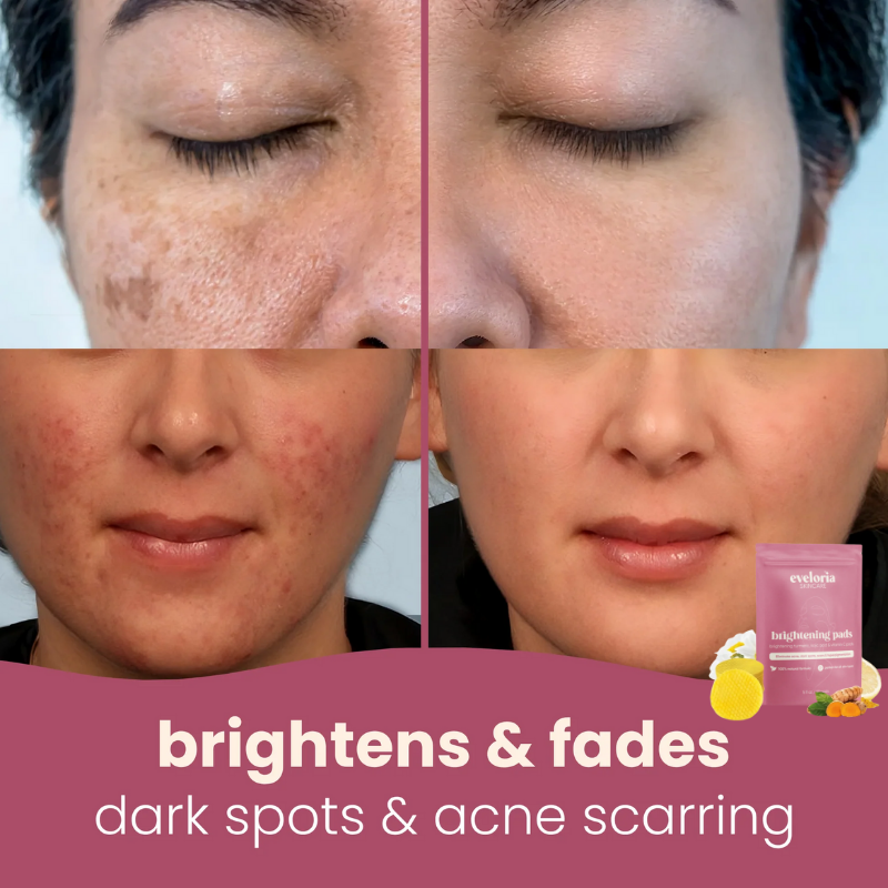Boobreeze™ Fade Pads – Kojic & Turmeric Formula - 30 Pads