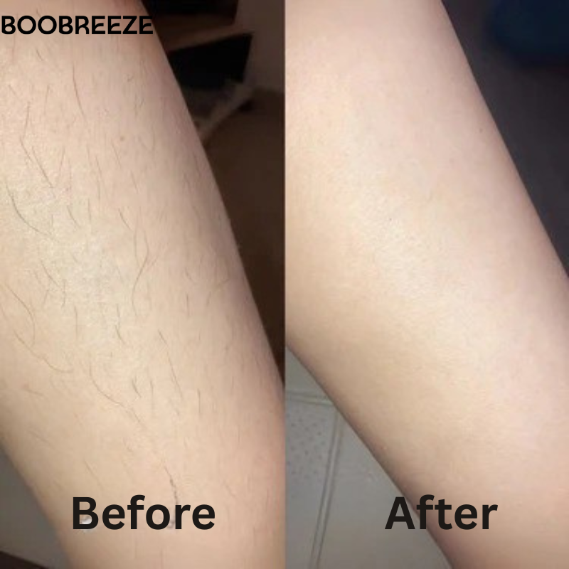 Boobreeze™ GlowTouch SkinPro Laser