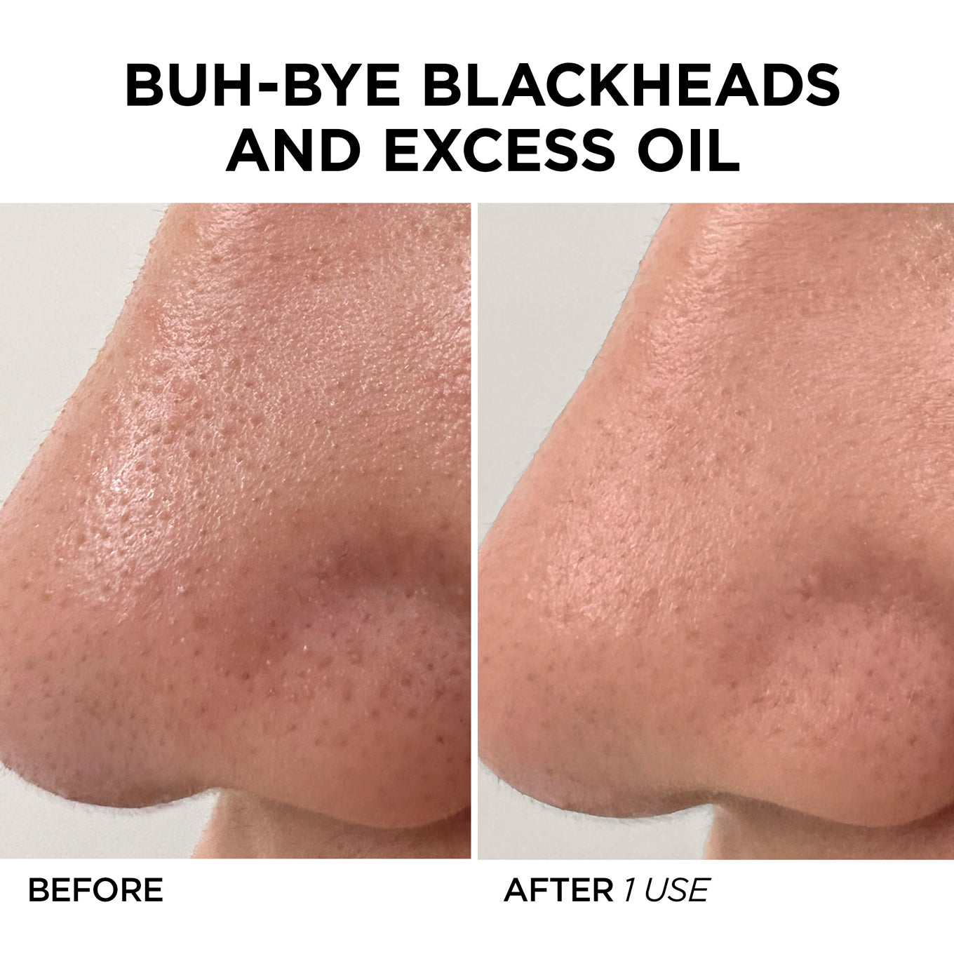 Boobreeze™ – Deep Pore Cleanser & Skin Hydrator