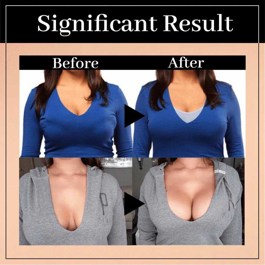 Boobreeze™ Wireless Posture Lift Up Bra
