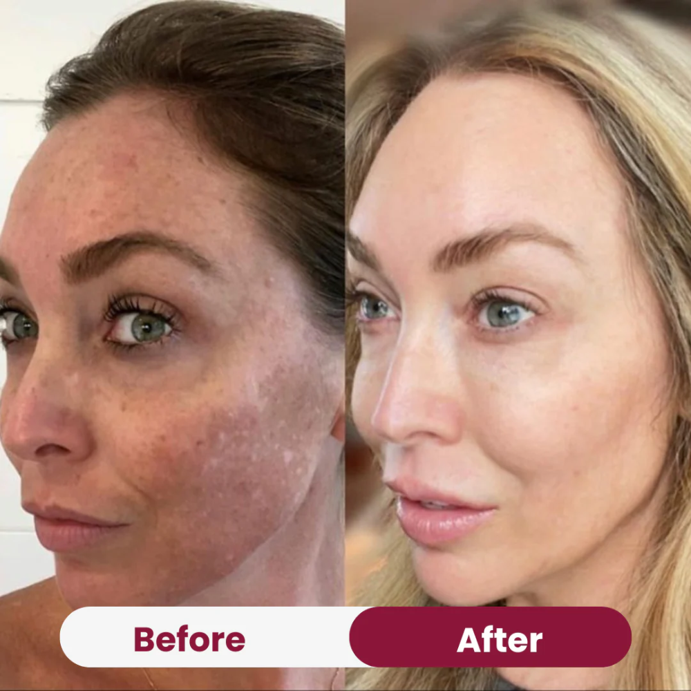 Boobreeze™ Nifora Bio Collagen Face Mask