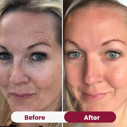 Boobreeze™ Nifora Bio Collagen Face Mask