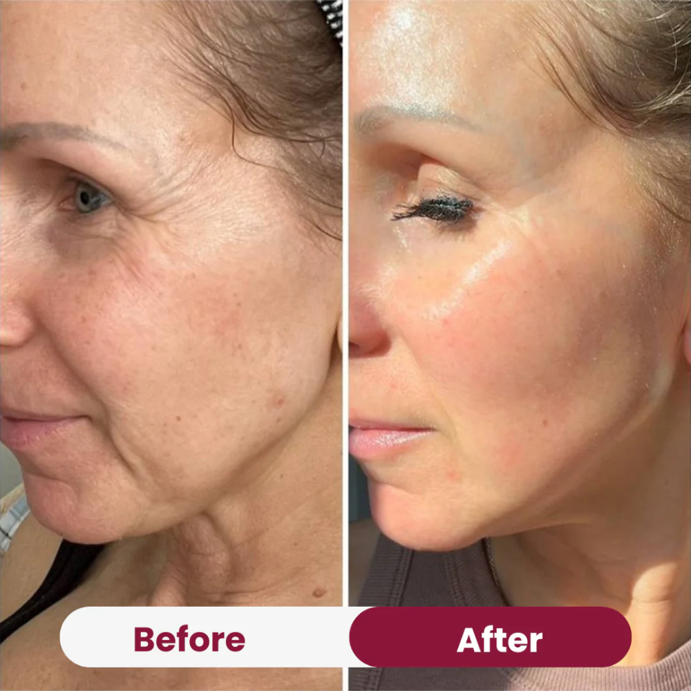 Boobreeze™ Nifora Bio Collagen Face Mask