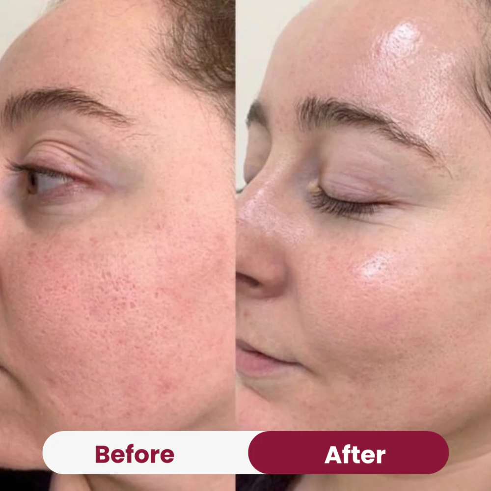 Boobreeze™ Nifora Bio Collagen Face Mask