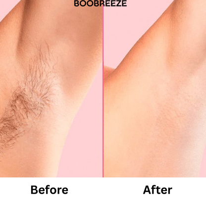 Boobreeze™ Pain Free Permanent Hair Removal
