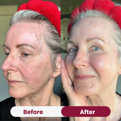 Boobreeze™ Nifora Bio Collagen Face Mask