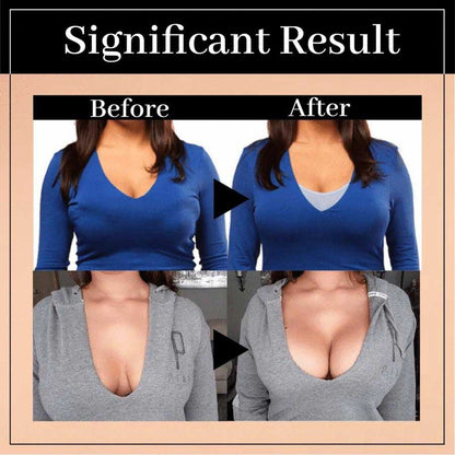 Boobreeze™ Wireless Posture Lift Up Bra